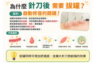為什麼針刀治療後需要拔罐?